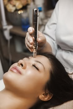 Microneedling for Hair