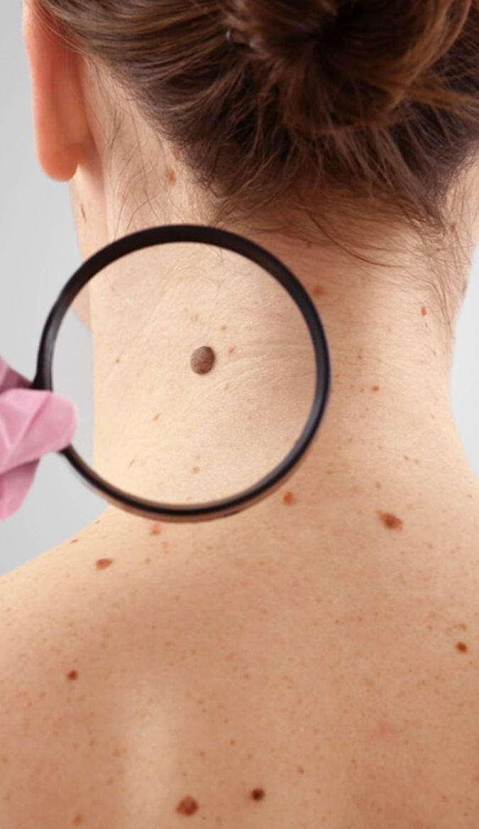 Clinical Dermatology