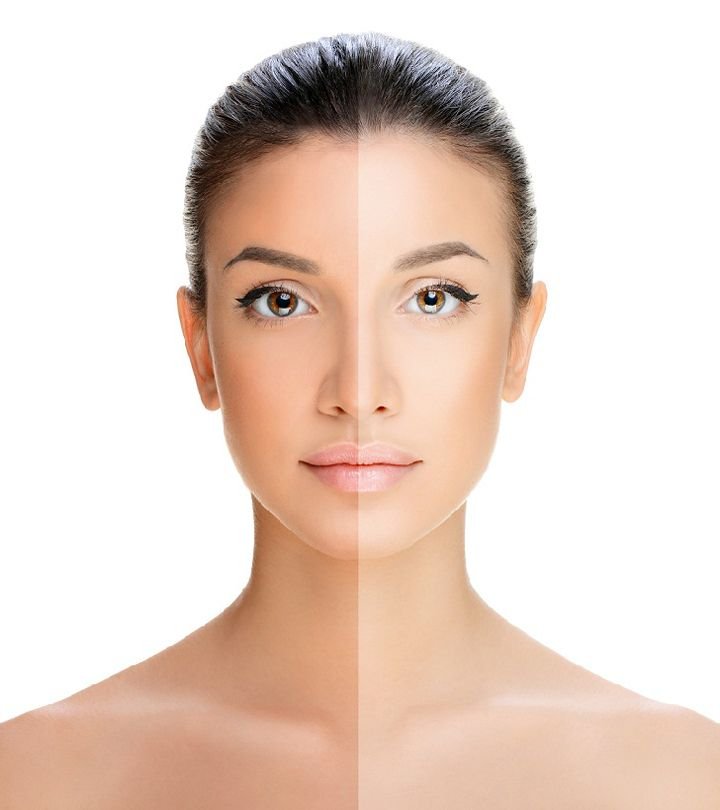 Skin Whitening
