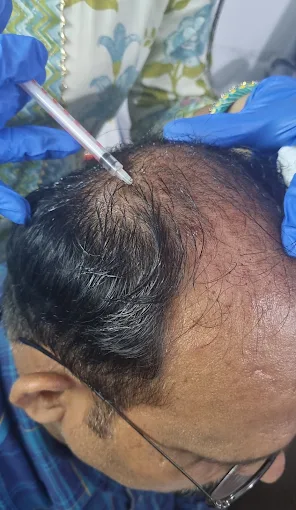 Precision Dermatosurgery
